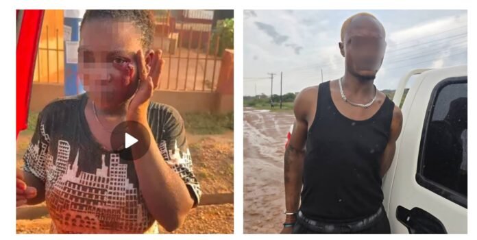 Ghana Police Rescue Victim , Arrest Suspect In Viral Domestic Abuse Case