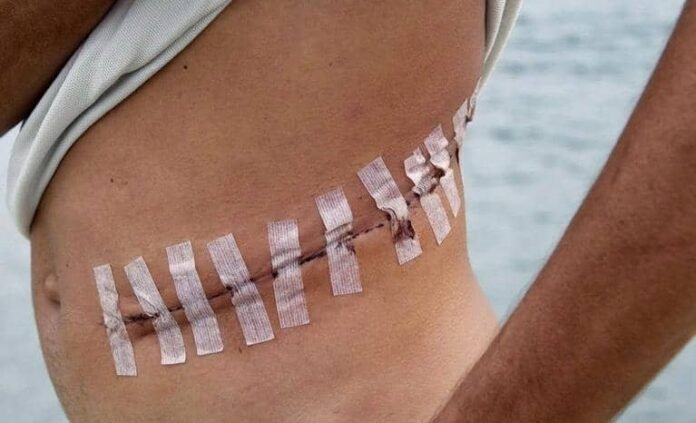 Organ Trafficking in Africa: Networks, Exploitation, and Systemic Impacts