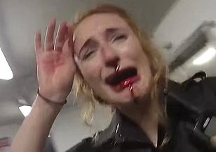 Officer Suffers Lasting Injuries After Knife Attack During Police Callout in Essex, Court Hears Officer Suffers Lasting Injuries After Knife Attack During Police Callout in Essex, Court Hears