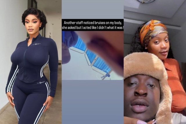 Outrage as Carter Efe’s Baby Mama Emmanuella Shares Evidence of Alleged Domestic Abuse