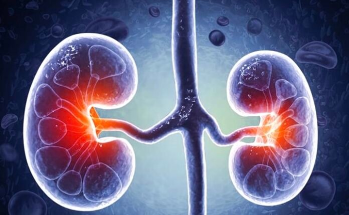 Around 4 Million Ghanaians Living with Kidney Disease, Specialist Raises Concern